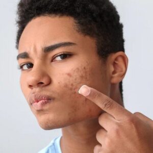 Crème visage