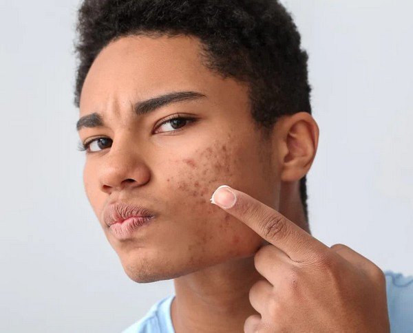 Crème visage